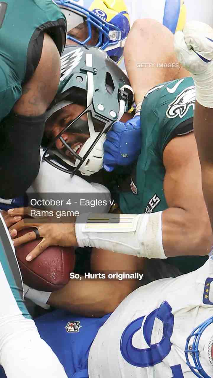 Quarterback Jalen Hurts diagnosed with a blood clot and emboli (pieces from the blood clot) in both his lungs (bilateral pulmonary emboli).

The Philadelphia Eagles who he plays for knew about the blood clot in his calf, it was superficial (close to the skin) but still let him travel from America to the UK to play against the Jacksonville Jaguars on 11-Oct-2026. 3 days later (14-Oct) the clot was discovered to have moved deeper within the calf, further from the surface (hence “deep vein”),  5 days later (19-Oct) parts of the blood clot (emboli) were discovered in his lungs too.